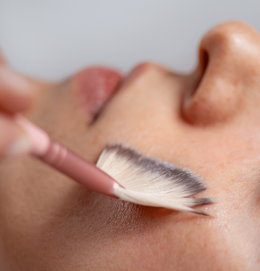 chemical-peel@2x chemical