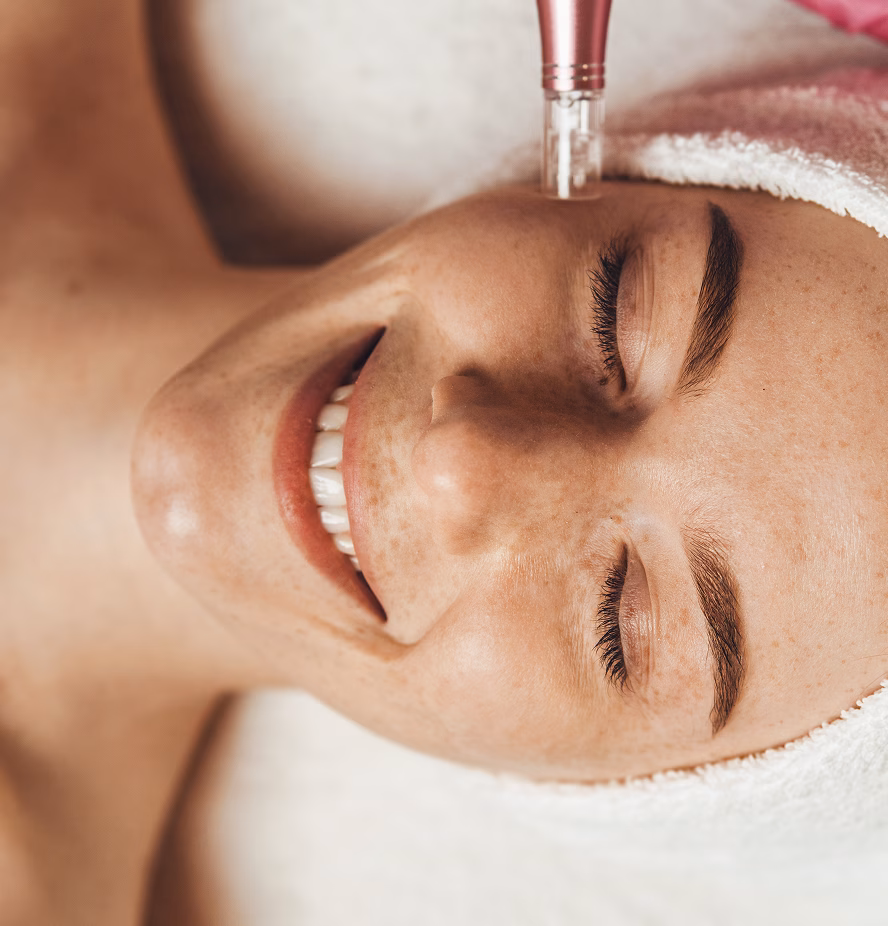 microneedling@2x_converted